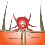 Do Chigger Bite Treatments Work On Delayed Reactions