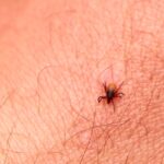 Do Chigger Bite Treatments Improve Healing Speed
