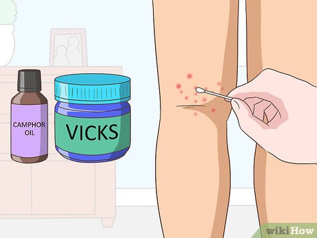Which Chigger Bite Treatments Bring Fast Relief