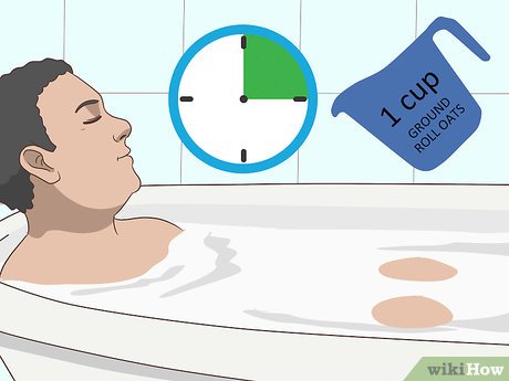 Why Chigger Bite Treatments Require Cleanliness